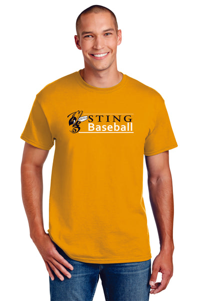 Sting Lines Tee- matte or glitter- 4 colors