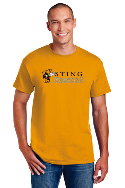 Sting Lines Tee- matte or glitter- 4 colors